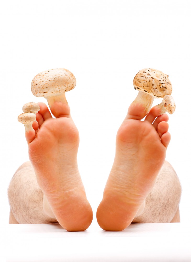 remedii de casă pentru a vindeca ciuperca unghiilor de la picioare