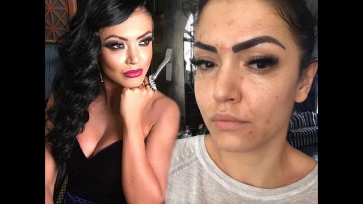 Andreea Mantea a aflat cauza problemelor de sănătate: „Am și pe spate, și pe mâini, pentru că eu știu la ce sunt alergică”