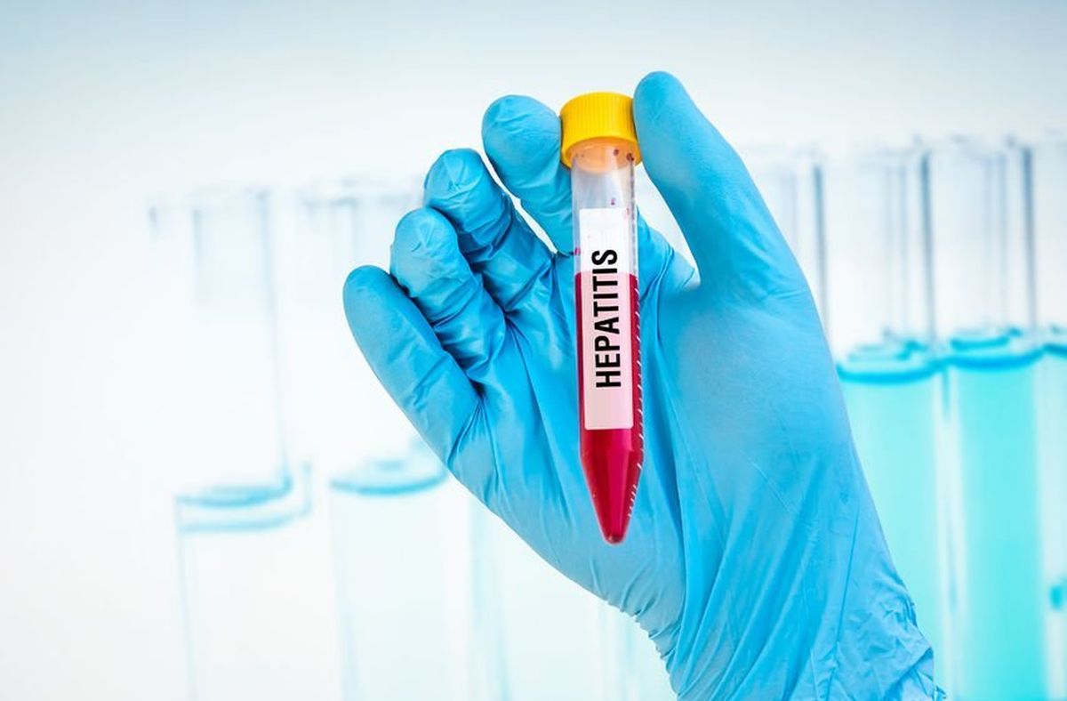 OMS a anunțat primul deces în legătură cu focarul de hepatită din Europa care afectează copiii
