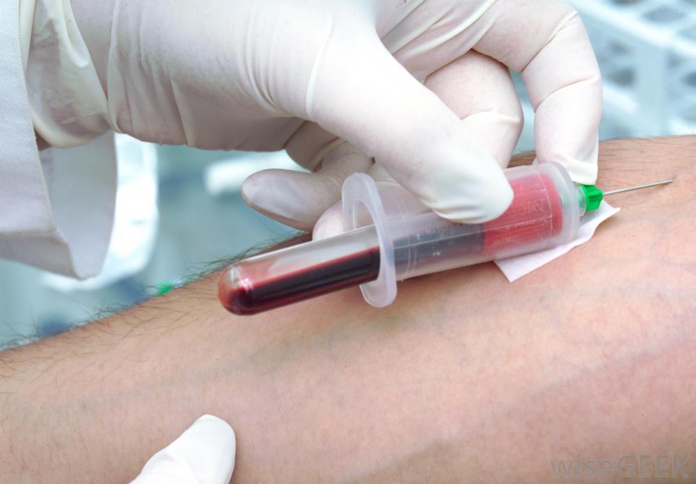 medic care ia o proba de sange cu siringa din vena unei persoane