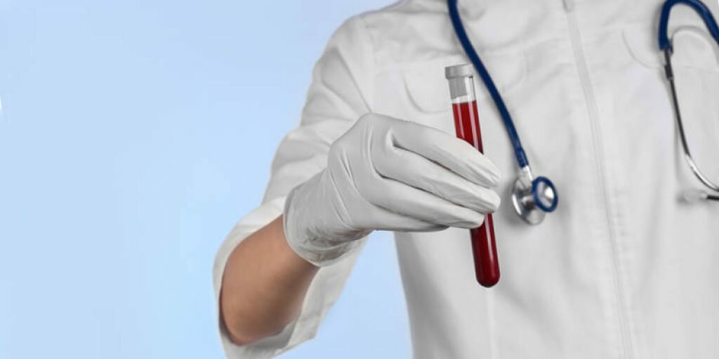 Anticoagulante naturale. Vitamine și alimente care te vor ajuta să subțiezi sângele