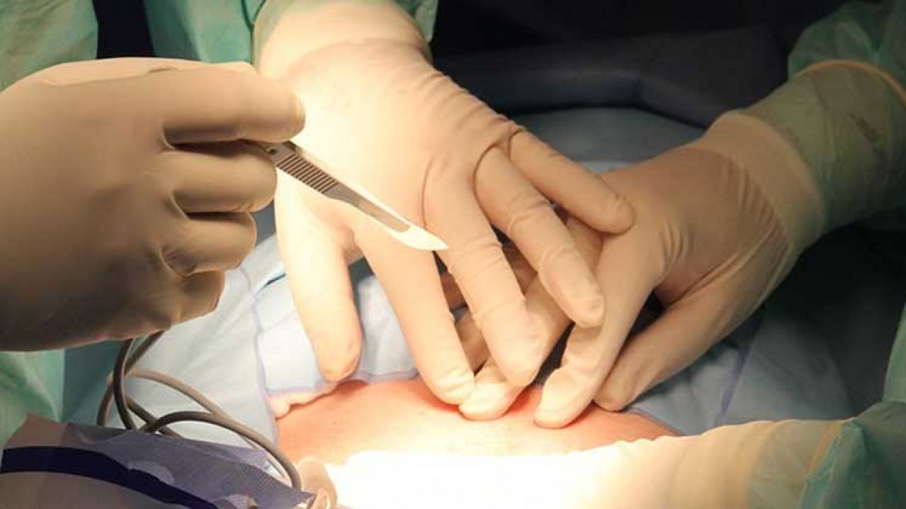 medici în timpul operației de cezariană