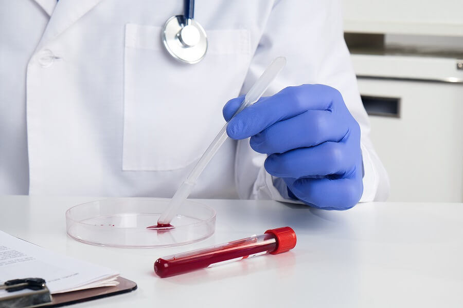 medic care analizeaza o proba de sange