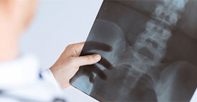 un medic care se uită pe o radiografie