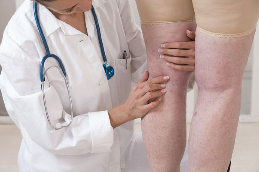 Ce medic tratează varicele? Află unde trebuie să mergi dacă te confrunți cu această afecțiune