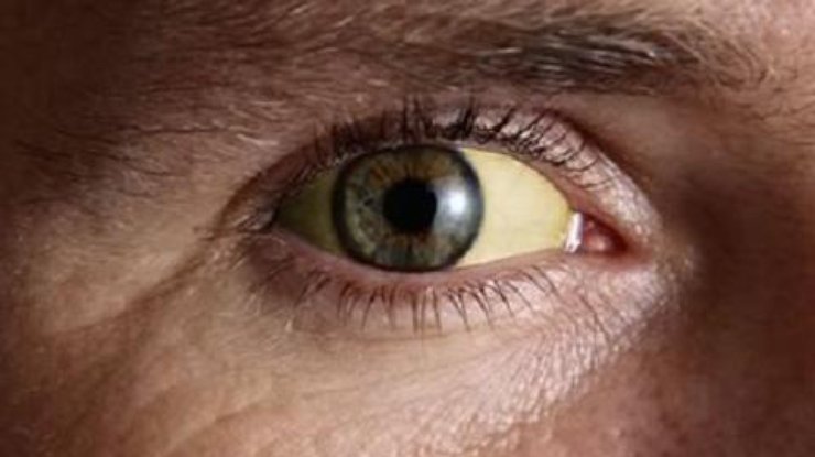 ochiul galben al unei persoane