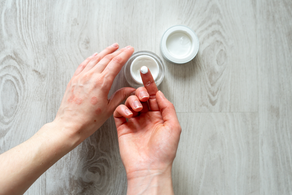 Rutina de îngrijire a pielii în dermatita atopică