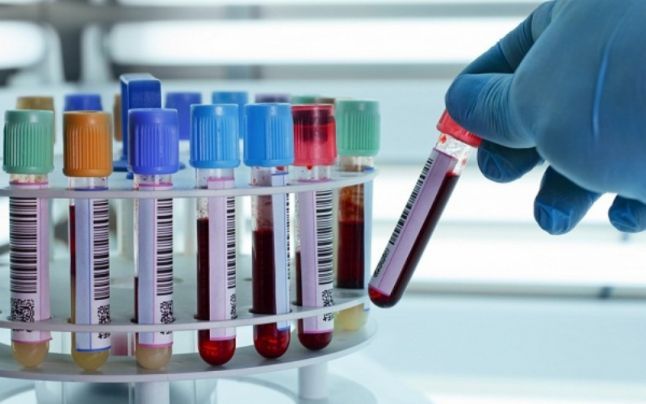 Analize de sânge pentru reumatism. Află care sunt recomandările medicilor reumatologi