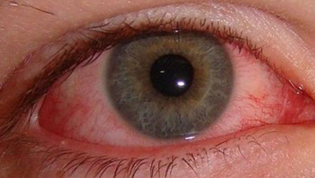 ochiul rosu din cauza curentului al unei persoane