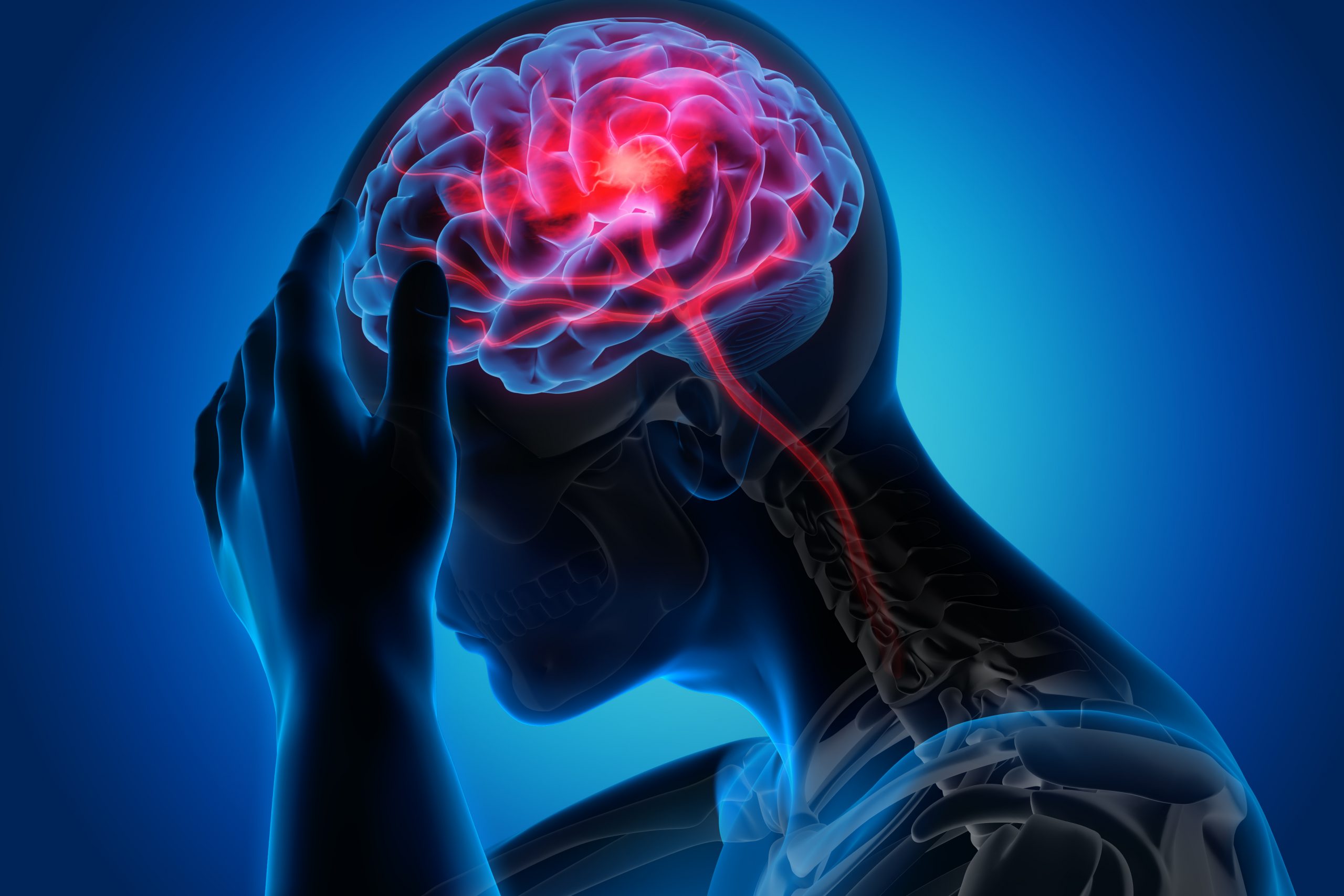 grafica creierul afectat de leucoaraioza a unei persoane
