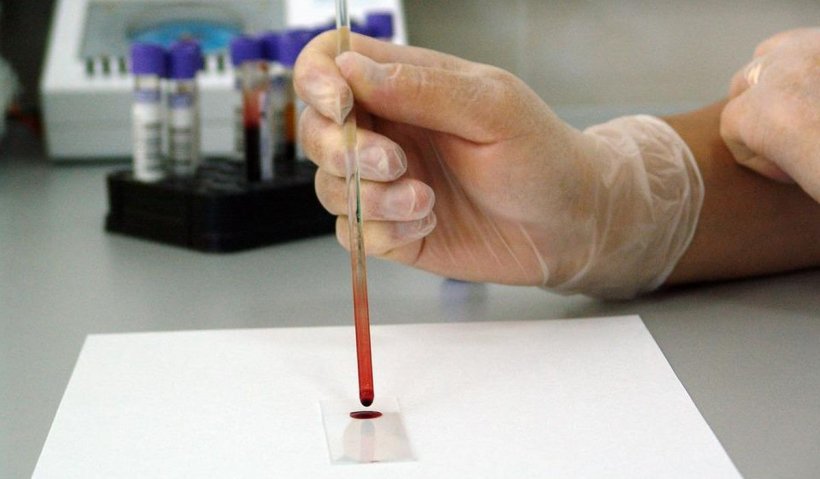 Primul tânăr confirmat cu variola maimuței în România are dosar penal. Acesta nu vrea să spună care i-au fost contacții direcți