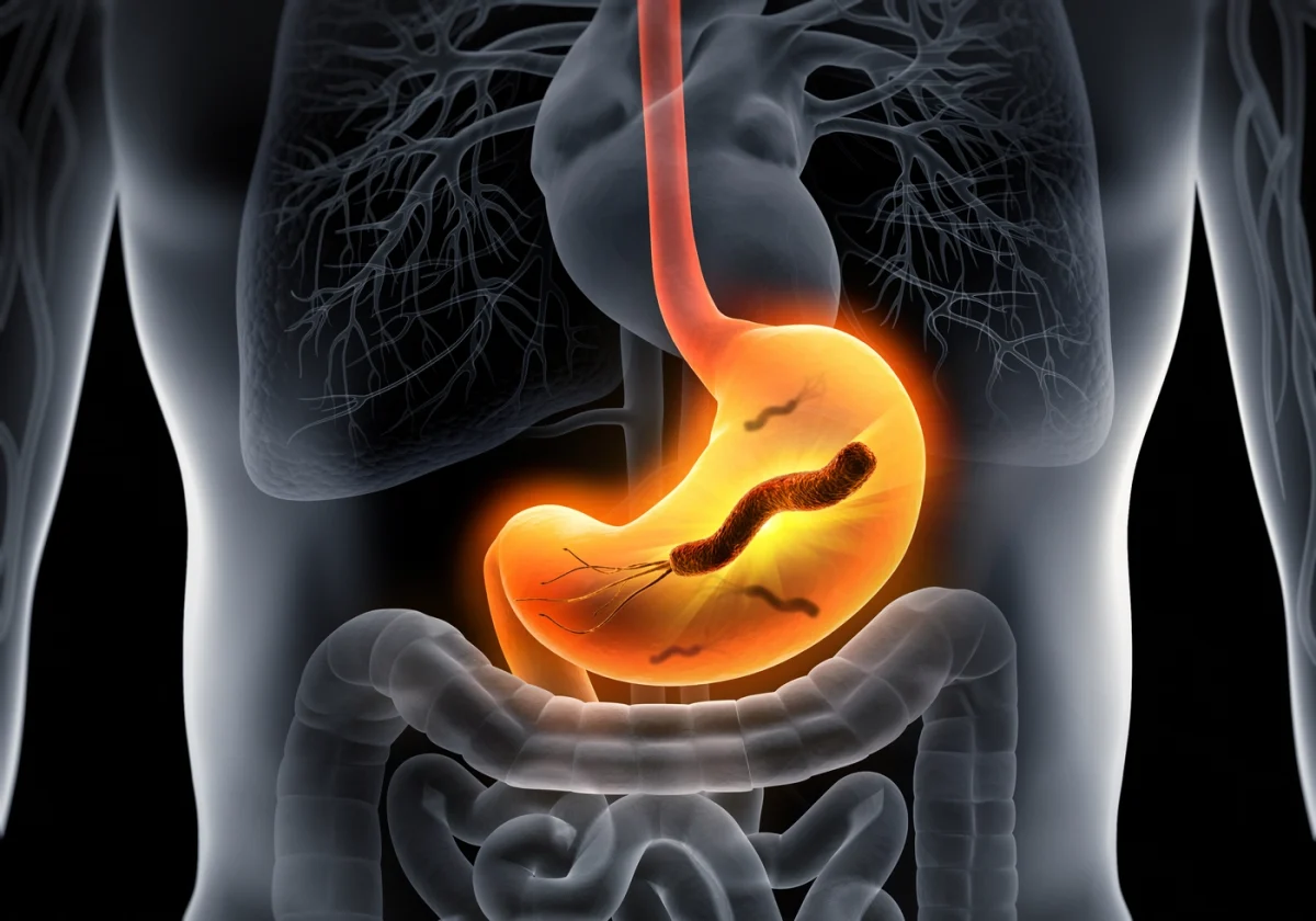 Cum am scăpat de E coli. Tratament medicamentos pentru a uita definitiv de bacterii intestinale