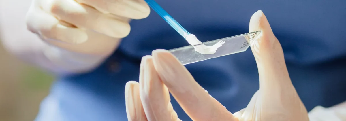 Scapă de candidă în 48 de ore. Tratamentul sigur pentru a scăpa de infecția vaginală