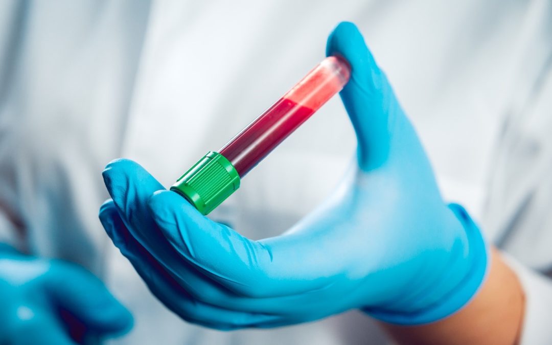 Analize care indică leucemia. Când trebuie efectuate testele de screening