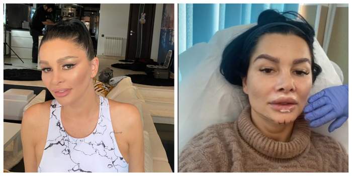 Brigitte Pastramă, la un pas de moarte din cauza intervențiilor estetice: „Am făcut embolie pulmonară”