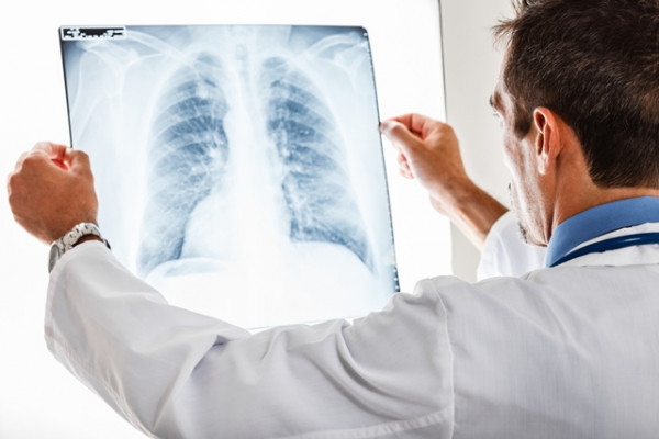 Ce este edemul pulmonar acut? Cum se manifestă afecțiunea și care este cel mai bun tratament