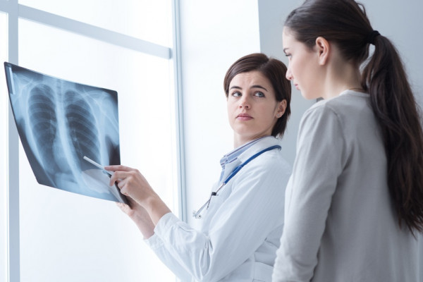 două femei care citesc o radiografie pulmonară