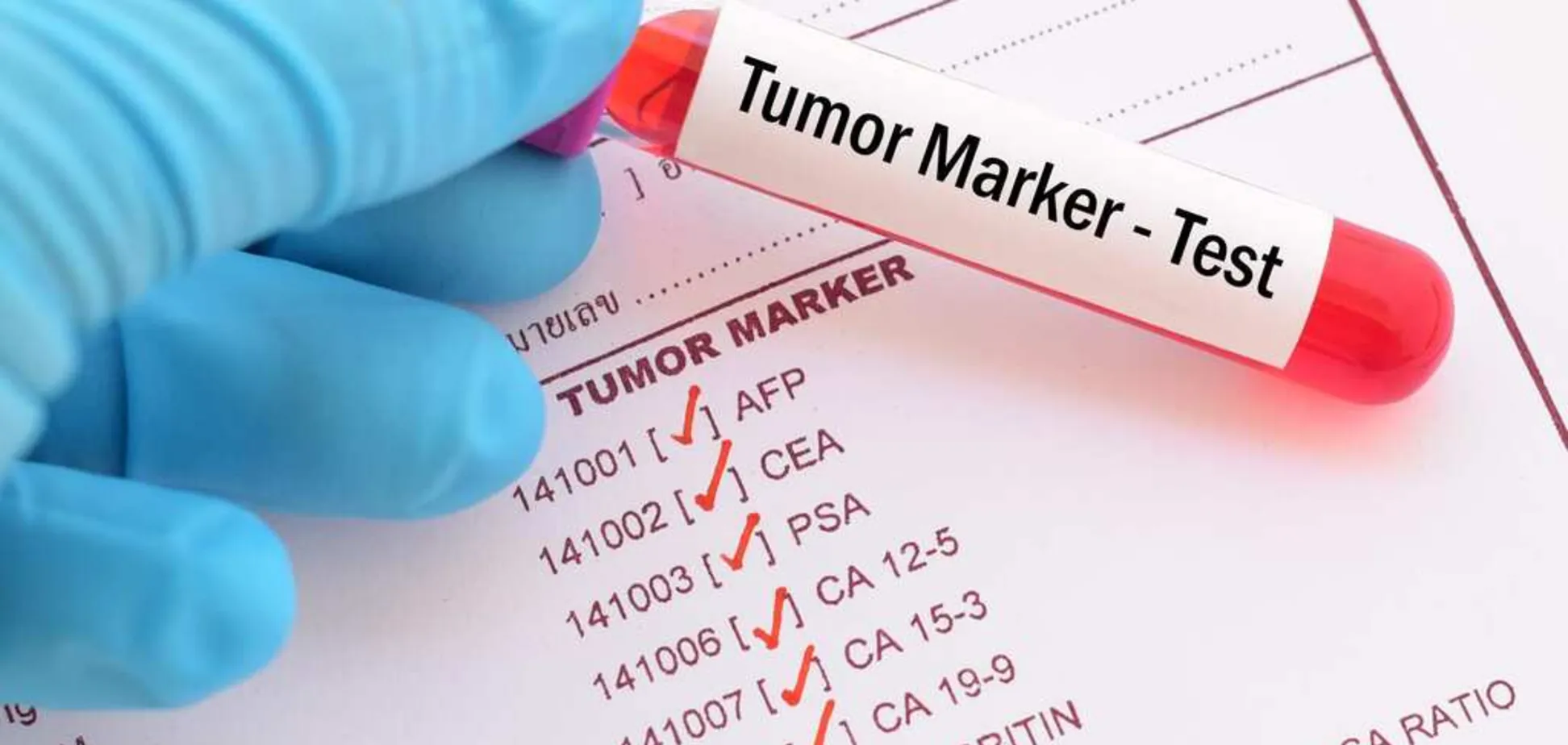 graduate development of trace Valori normale markeri tumorali. Afecțiuni care pot fi identificate  datorită acestora