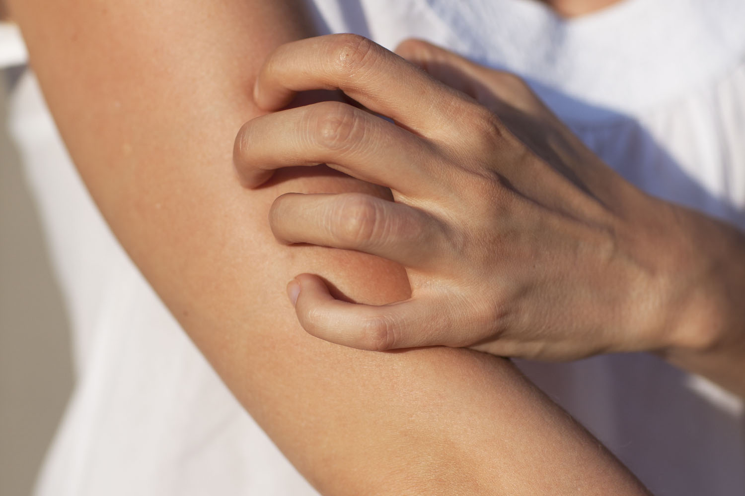 o femeie care se scarpină pe mână din cauza eczemei