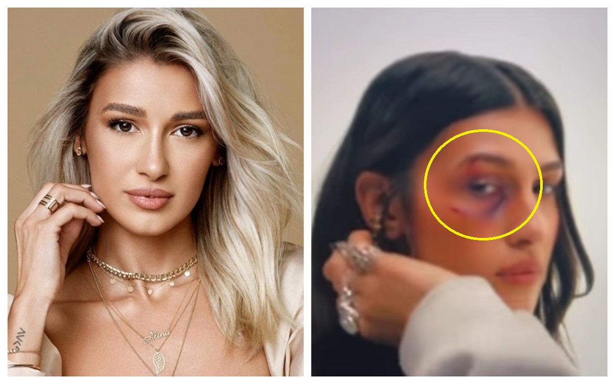 Alina Eremia s-a pozat cu ochiul vânăt și a distribuit fotografia pe Instagram. Ce s-a întâmplat în viața îndrăgitei artiste?