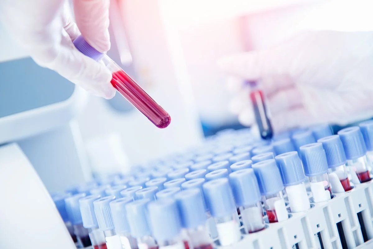 O nouă eră a screening-ului pentru bolile grave. Mai multe tipuri de cancer, identificate cu ajutorul unui test de sânge