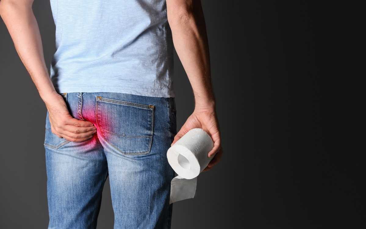 Hemoroizii externi dispar. Factorii de care depinde frecvența exacerbărilor