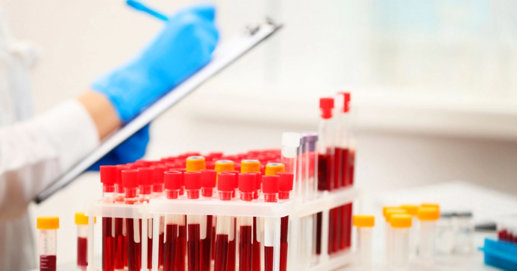 Neutrofile mărite. Consecințele diagnosticului și metoda de tratament