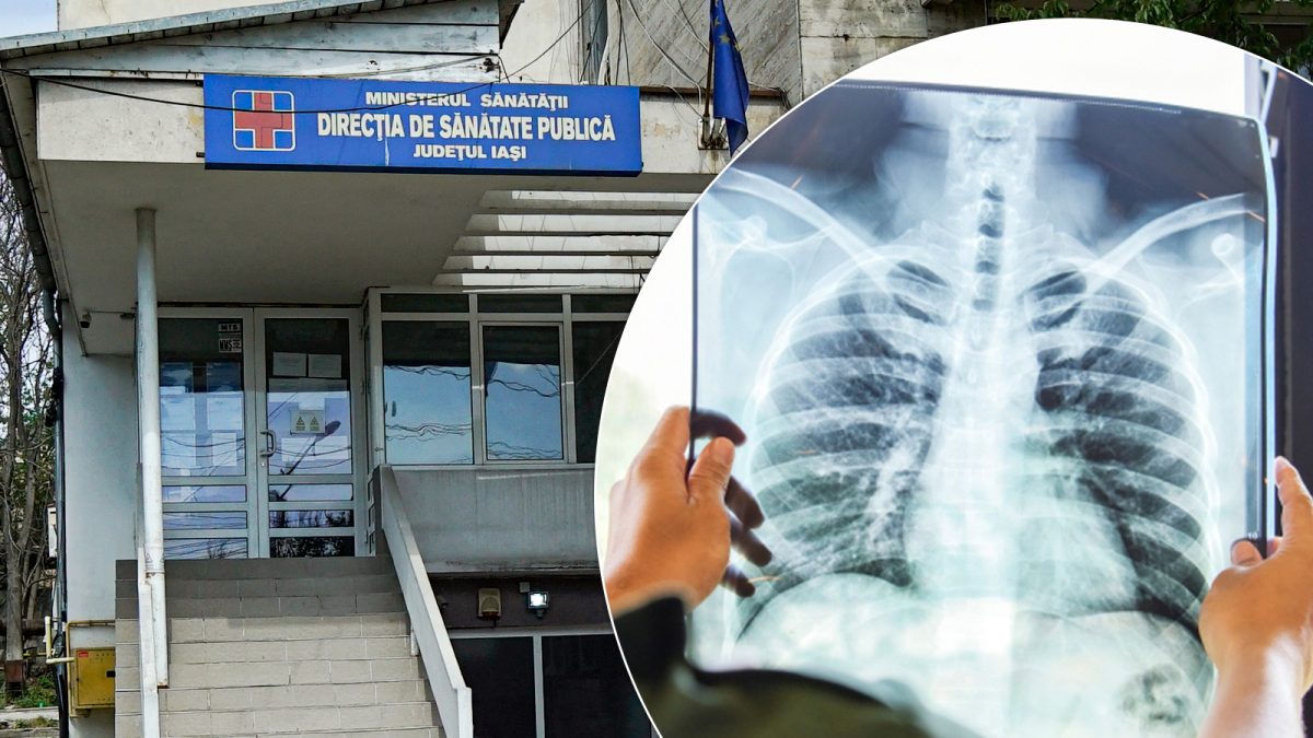 Screening gratuit pentru depistarea tuberculozei în județul Iași! Se dorește testarea a 3.000 de persoane cu risc ridicat de îmbolnăvire!