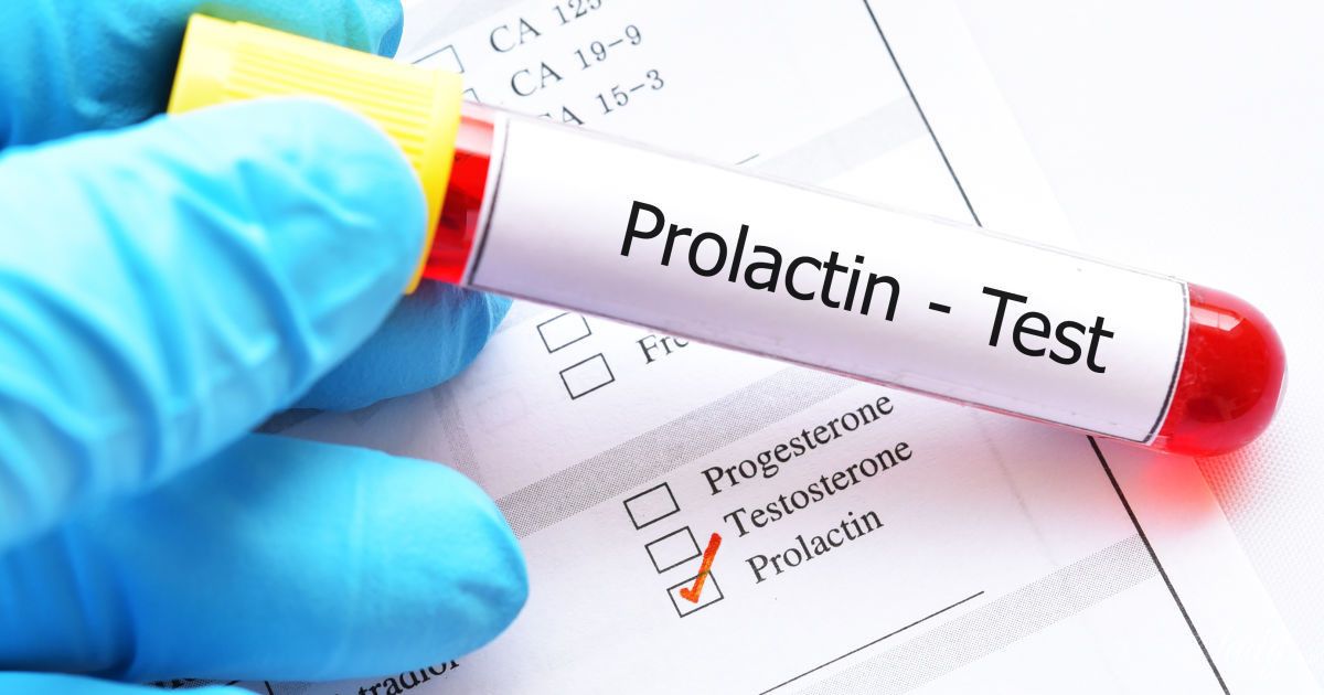 Prolactina mărită. O problemă comună cu care se confruntă tot mai multe femei