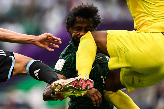 Tragedie la Campionatul Mondial. Așa arată radiografia jucătorului accidentat în meciul Argentina-Arabia Saudită – VIDEO/FOTO