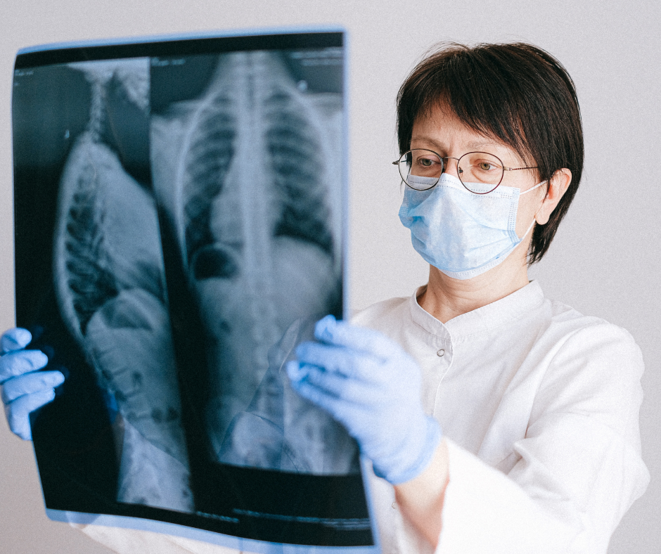 În cât timp se vindecă pneumonia interstitială? Medicamente prescrise de medici pentru a ameliora rapid simptomele