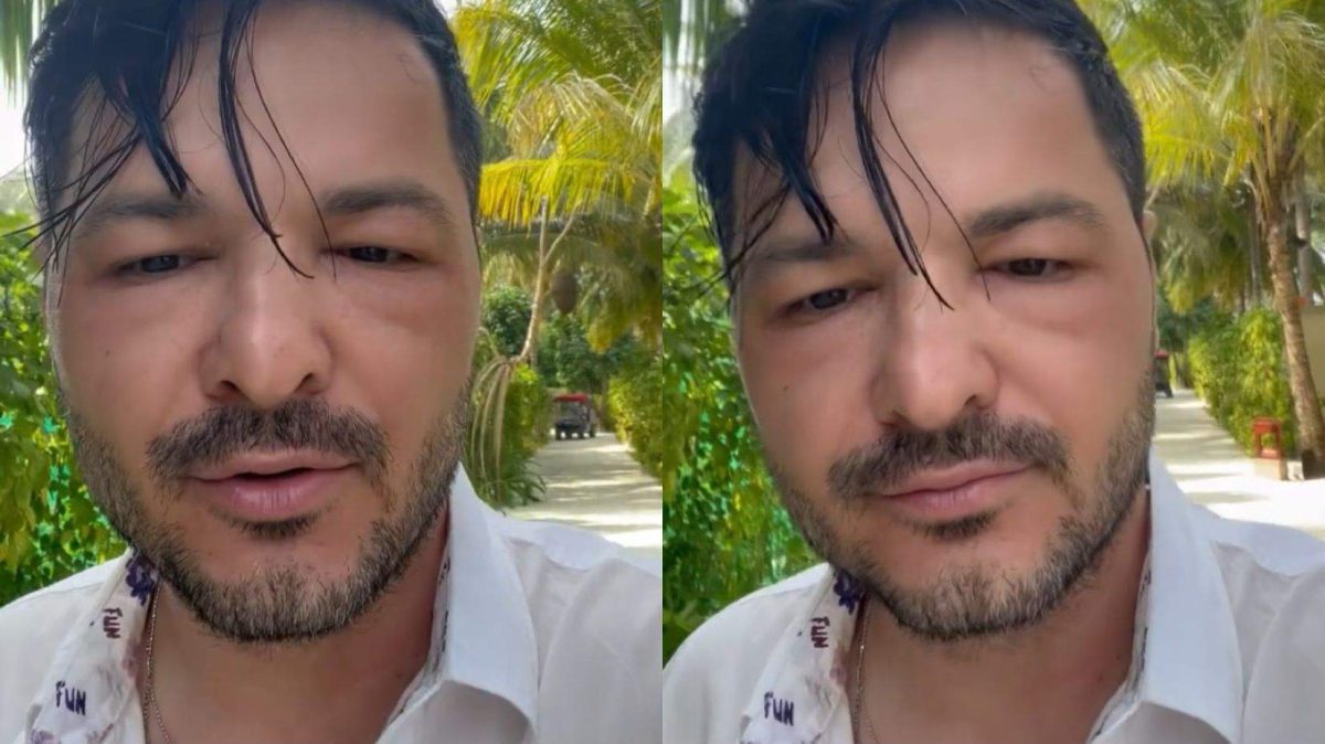 Liviu Vârciu, probleme în vacanța din Maldive! Prezentatorul TV s-a trezit cu fața umflată – FOTO