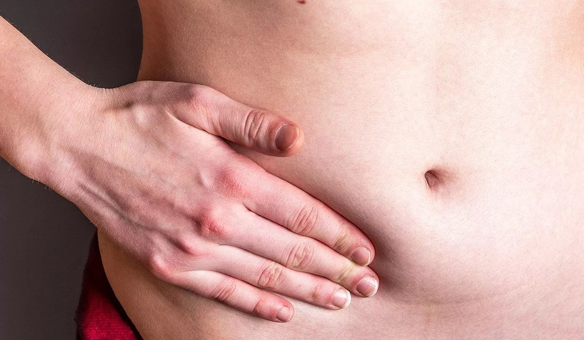 Poze cu hernie abdominală. Metodele prin care se stabilește diagnosticul