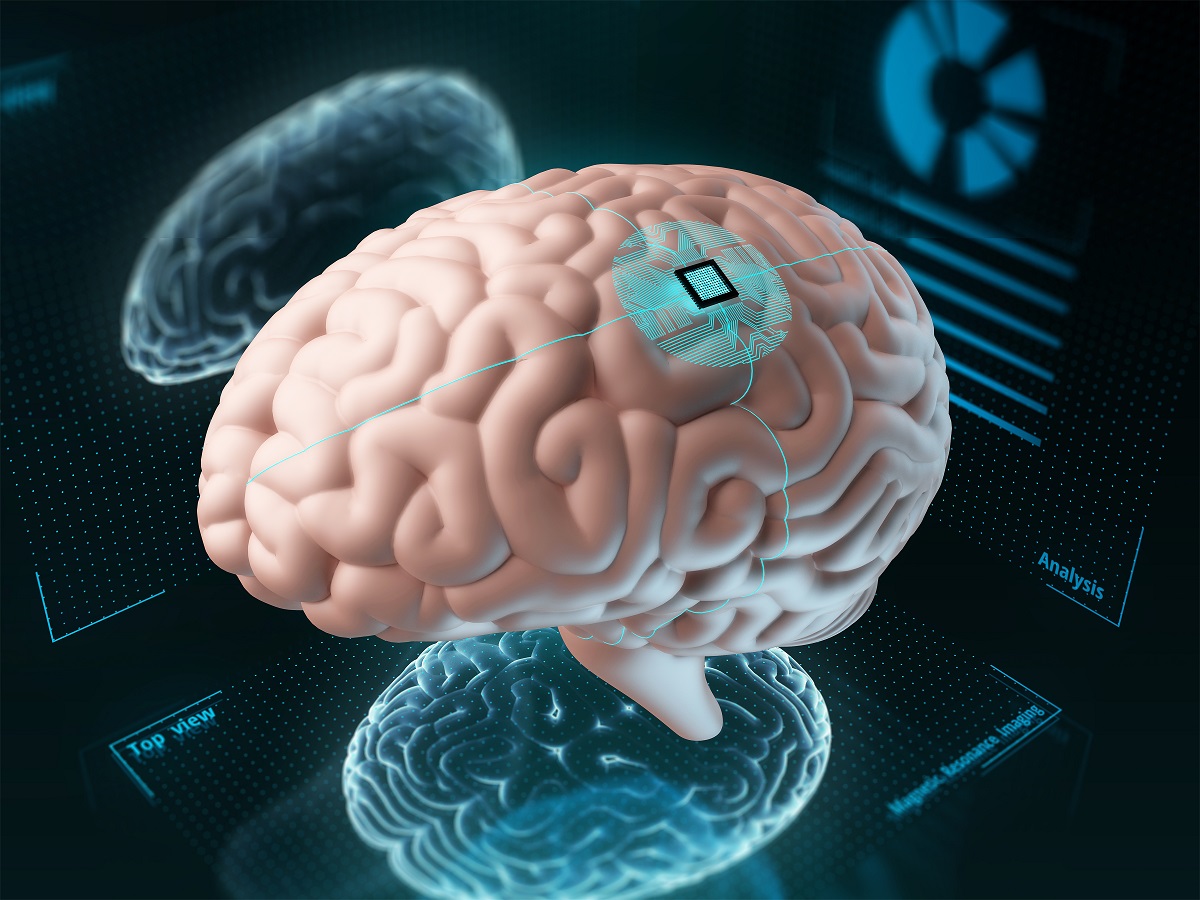 Implantate în creier, cipurile lui Elon Musk ne-ar putea schimba personalitatea