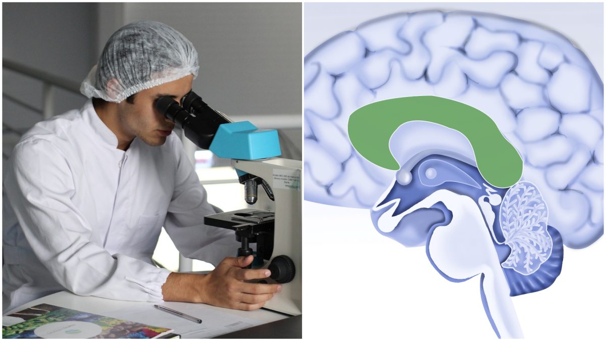 Neurologii au diagnosticat cel mai tânăr caz de Alzheimer raportat vreodată