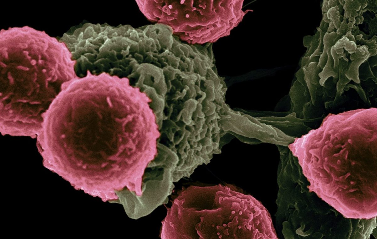 Un nou studiu al cercetătorilor arată cum celulele canceroase mor de foame fără această proteină