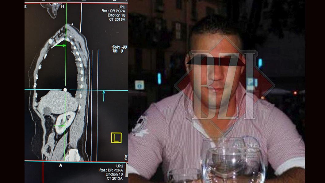Iată glonţul care a fost tras de Plop în cartierul Alexandru cel Bun. Medicii nu l-au extras din trupul victimei