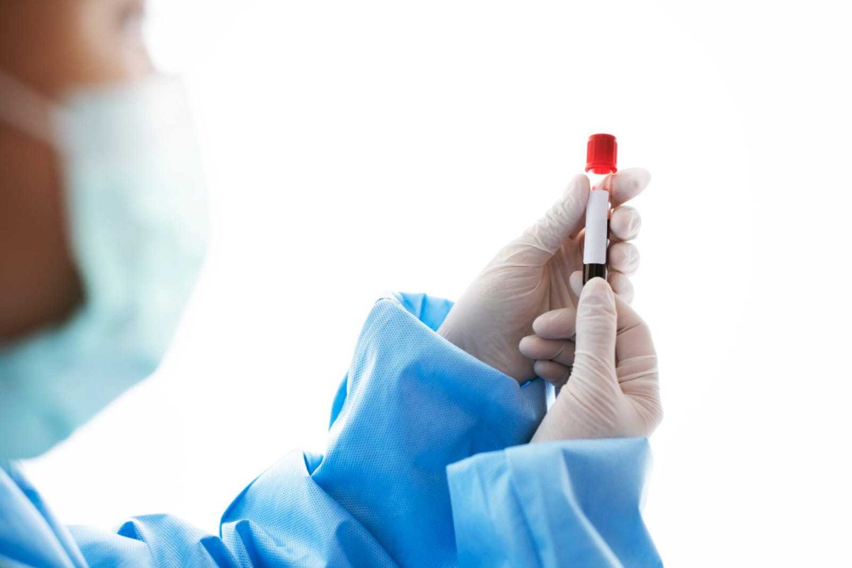 Tratament fibrinogen crescut. Cum să te pregătești pentru o recoltare de sânge