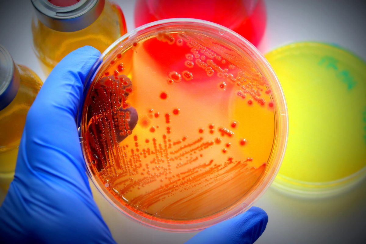 Ce este Escherichia coli și cum afectează organismul? Află totul despre această bacterie periculoasă – VIDEO