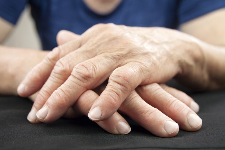 Care este diferența dintre artrită și artroză? Explicațiile medicului Dan Cionca – VIDEO