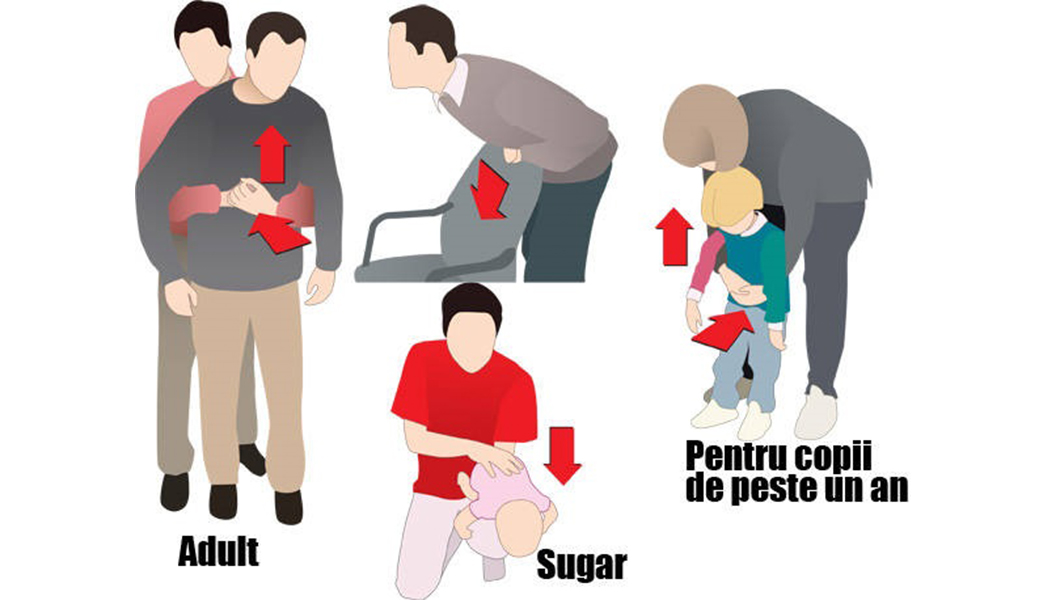Mesajul medicului ieșean Tudor Ciuhodaru după ce o fetiță de 14 ani a murit înecată cu un jeleu: „Vreau că noțiunile de prim ajutor să fie predate în toate școlile din România”