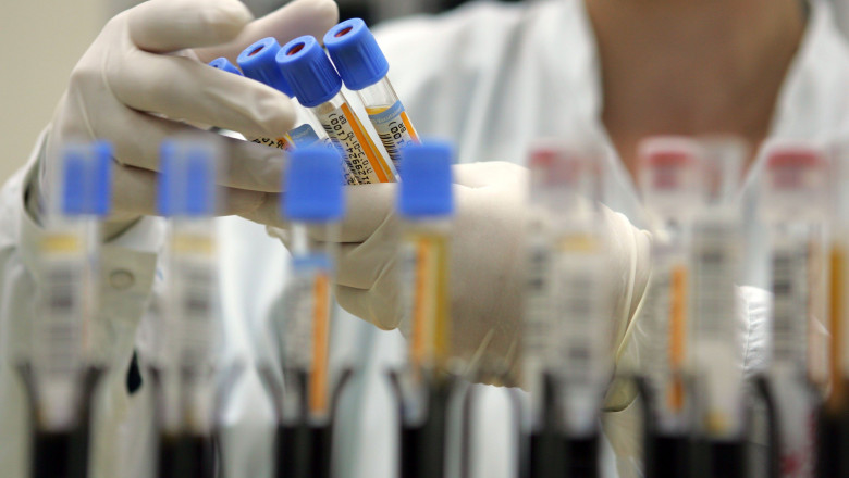 Trei persoane infectate cu Antrax au fost internate la Spitalul de Boli Infecţioase din Iaşi