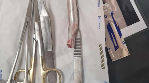 Un medic este acuzat că a cusut în piciorul unui tânăr mânerul de frână de la bicicletă