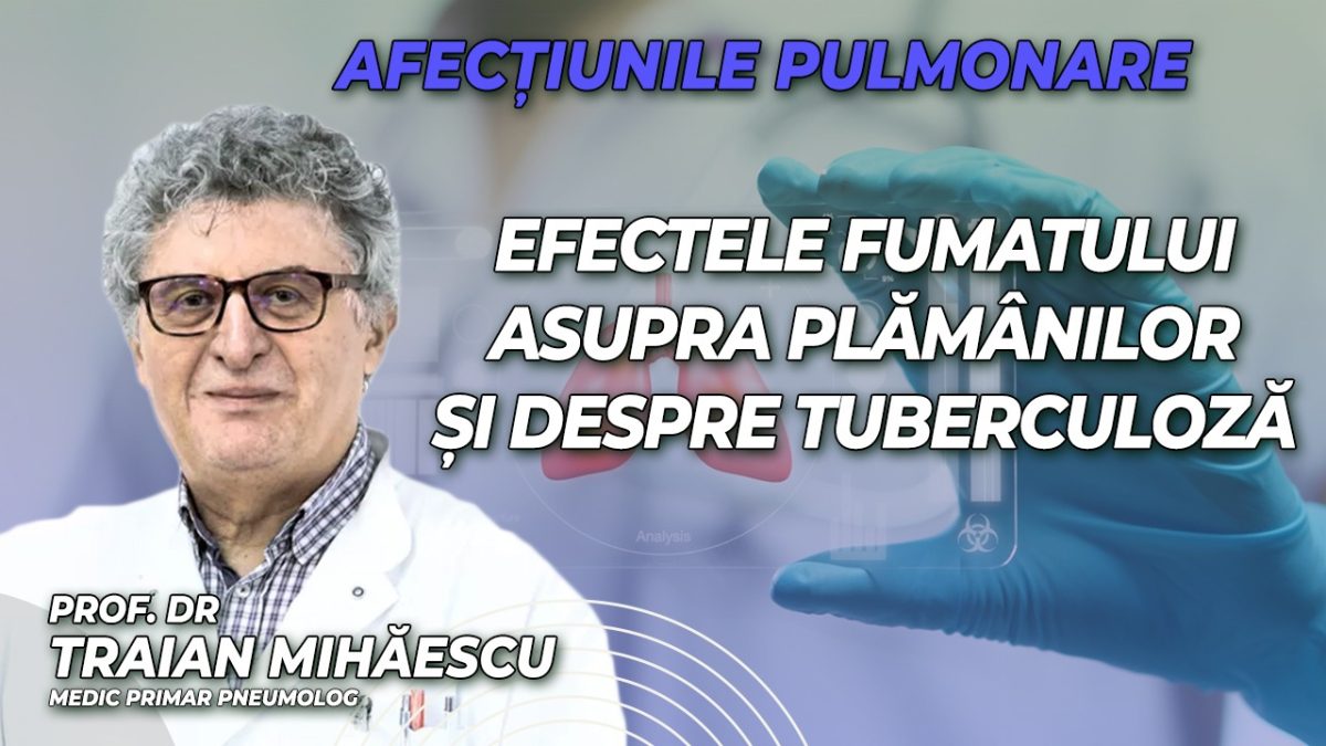 Prof. dr. Traian Mihăescu, medic primar pneumolog discută în emisiunea de sănătate BZI LIVE despre afecțiunile pulmonare, despre efectele fumatului asupra plămânilor și despre tuberculoză