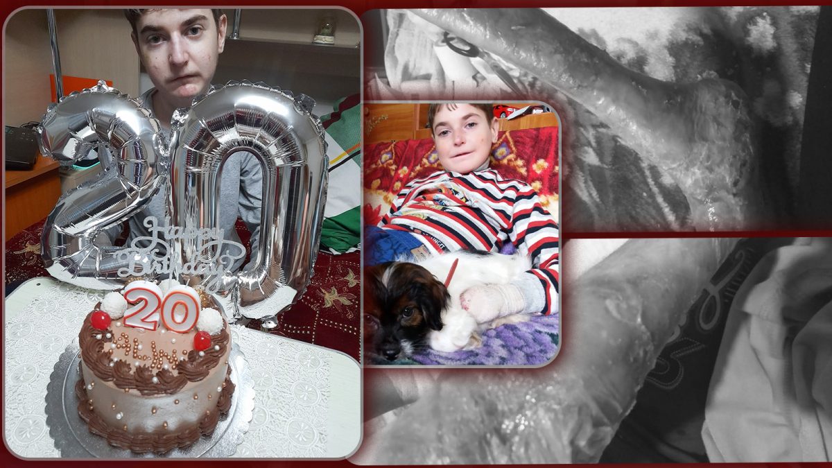 Când s-a împărțit durerea, un tânăr a primit mai mult decât putea duce. Alin se luptă, de 20 de ani, cu o boală care-i mănâncă trupul – FOTO