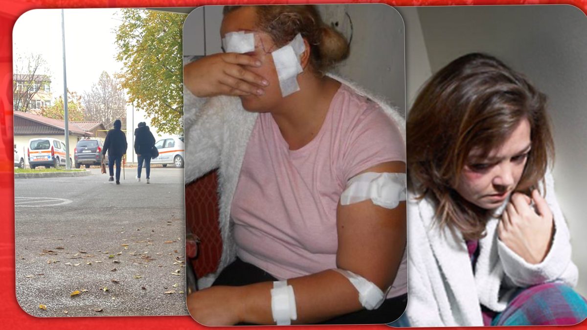 Luptă pe viață și pe moarte! O femeie care s-a căsătorit din dragoste a fost mutilată de soț pe veci: „A fost nevoie să-mi scoată ochiul” – FOTO