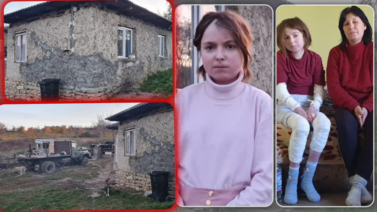 Apel umanitar pentru o tânără din Iași, diagnosticată cu epidermoliză buloasă – FOTO