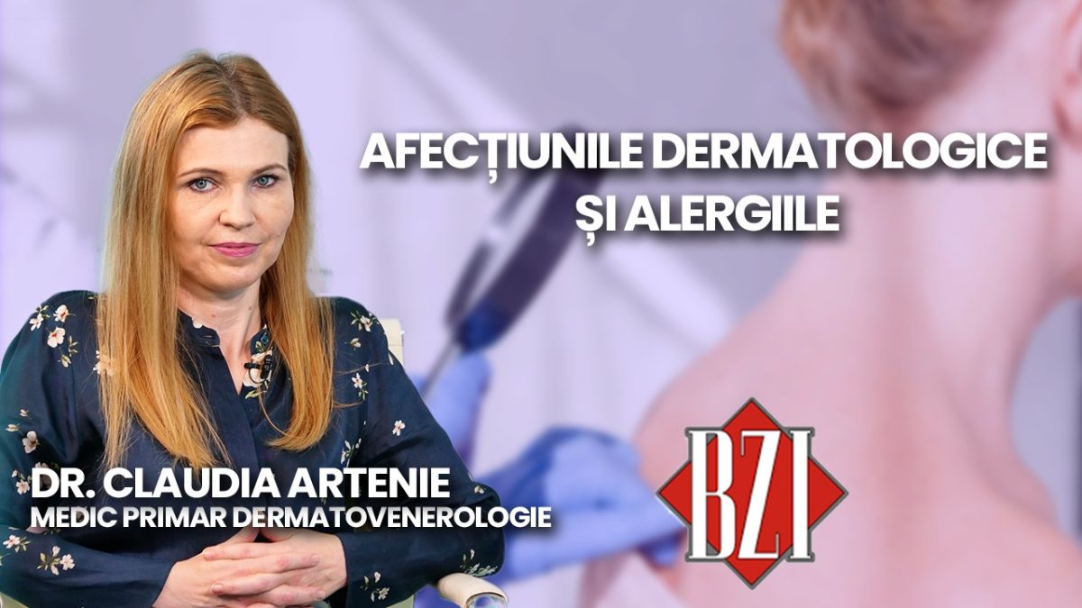 Dr. Claudia Artenie, medic primar dermatovenerologie, discută în emisiunea BZI LIVE despre cancerul de piele