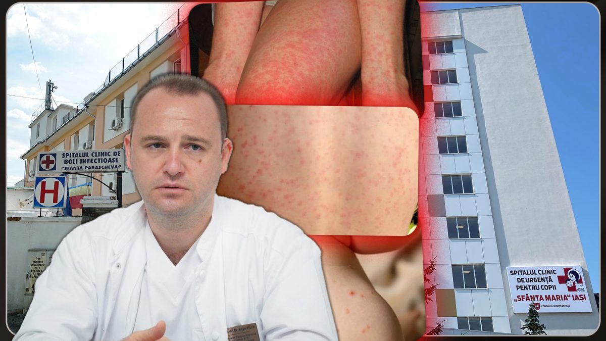Medicii ieșeni îi liniștesc pe părinți! Nu ne confruntăm cu o epidemie de scarlatină: „Nu sunt mai multe cazuri decât de obicei” – FOTO