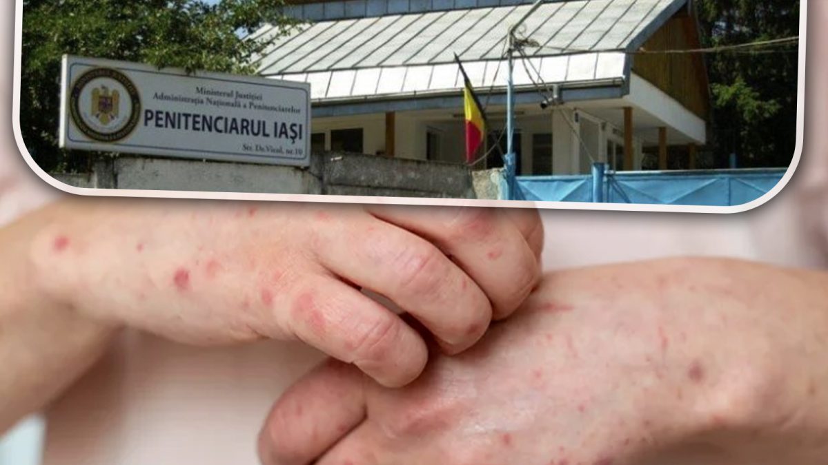 Administrația Națională a Penitenciarelor confirmă dezastrul din Penitenciarul Iași! Oficial: mai mulți deținuți s-au umplut de scabie: „Au fost raportate șase cazuri” – FOTO